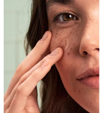 AHA anti-acne serum 5% Solve On 30 ml. - Health Labs Care 3