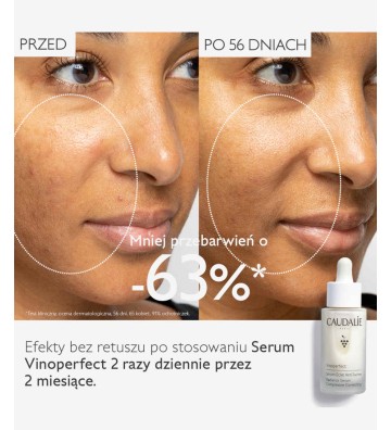 Vinoperfect Brightening Dark Spot Serum Rozjaśniające Przebarwienia 30ml - Caudalie 5