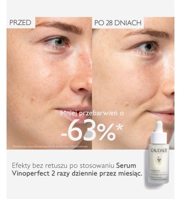 Vinoperfect Brightening Dark Spot Serum Rozjaśniające Przebarwienia 30 ml - Caudalie 4