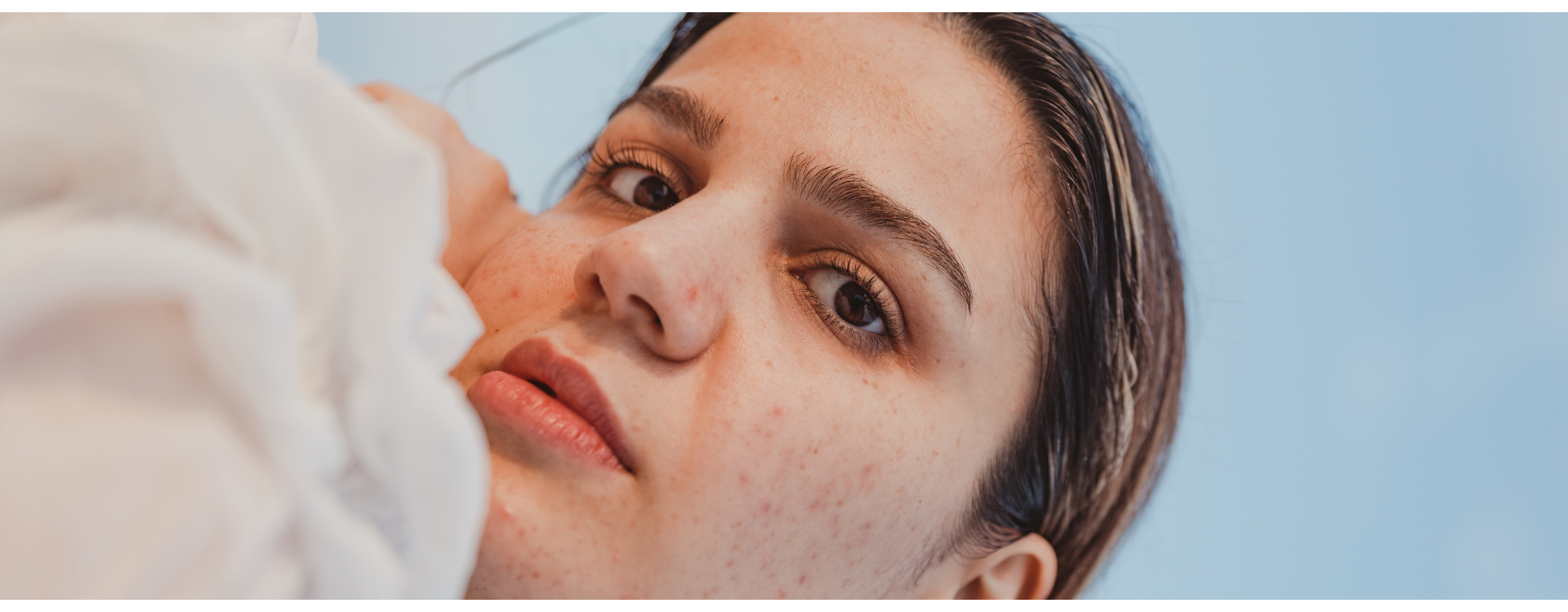 Kolagen na trądzik – jak działa i jaki wybrać na cerę problematyczną